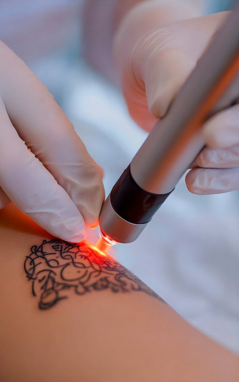 Laser picoseconde, centre Detatou à Nancy