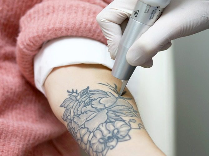 Tatouage et grossesse : ce que la prudence médicale recommande 1 tatouage et grossesse consultation médicale