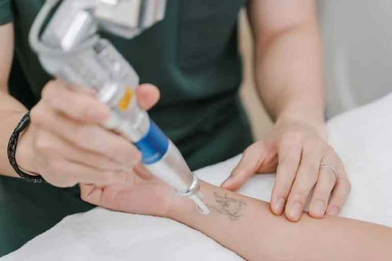 Préparation de la peau avant une séance de détatouage laser